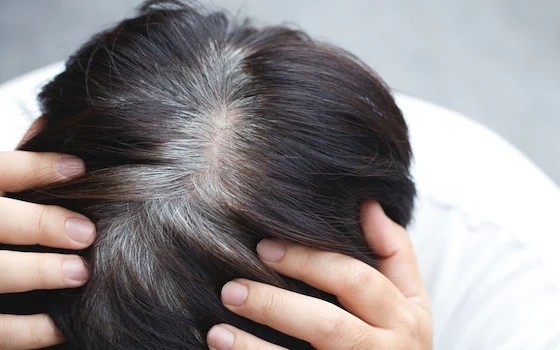 5 nguyên liệu tự nhiên giúp cải thiện tóc bạc sớm